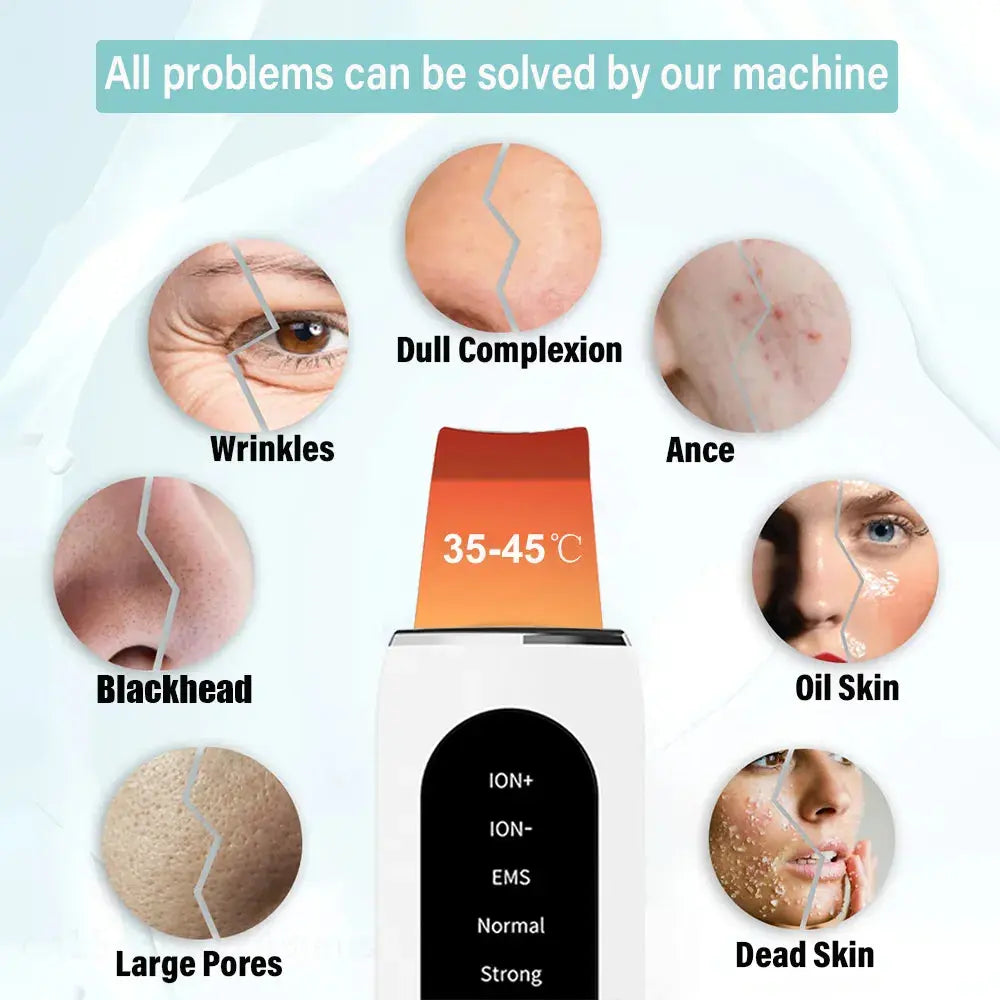 Ultrasonic Skin Scrubber: Peeling, Blackhead Remover & Tiefenreinigung - Raffiniertedinge Ultrasonic Skin Scrubber: Peeling, Blackhead Remover & Tiefenreinigung - Raffiniertedinge